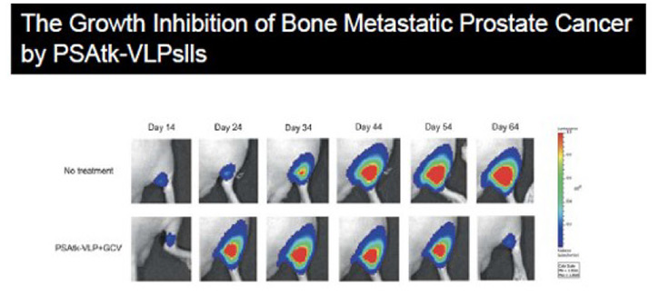 Bone Metastatic Prostate Cancer Inhibition